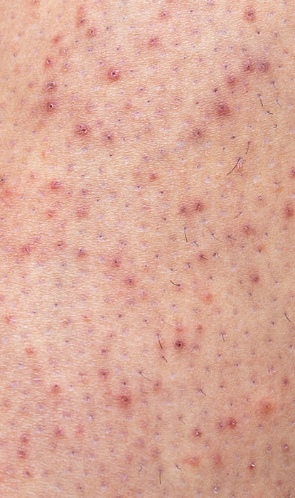 2. Shaving Causes Invisible Skin Damage — And It Shows More As You Age