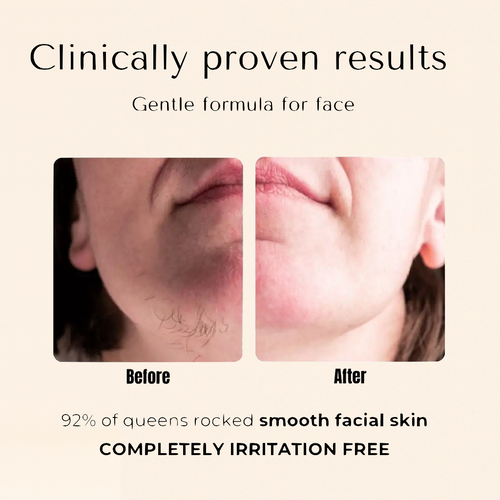 Okono –  Cyperus Rotundus Oil – Hair Reduction Oil