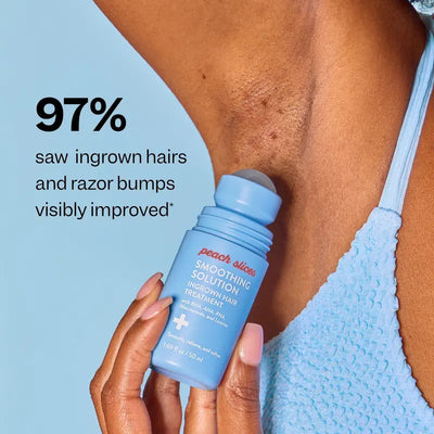 Skin Smoothing Solution For Bumps, Ingrown Hairs, & Dark Spots