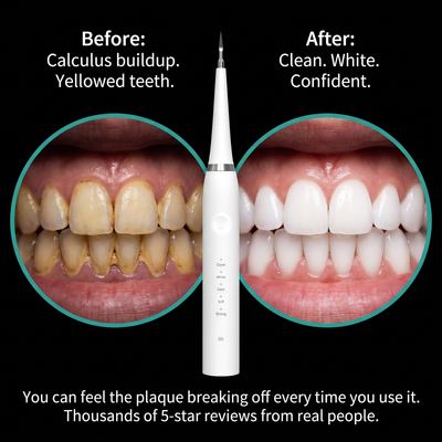 OKONO Dental Plaque Remover