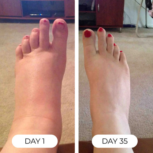 Organic Lymphatic Support Herbal Blend