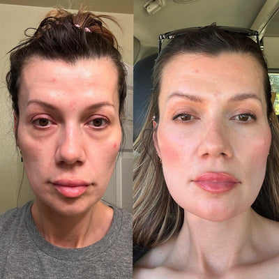 Red Light Micro-Current Massage Under Eye Therapy