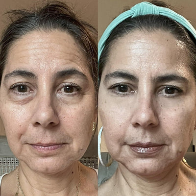 Red Light Micro-Current Massage Under Eye Therapy