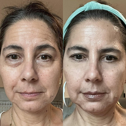 Red Light Micro-Current Massage Under Eye Therapy