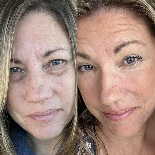 Red Light Micro-Current Massage Under Eye Therapy